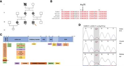 Hyper-IgE and Carcinoma in CADINS Disease